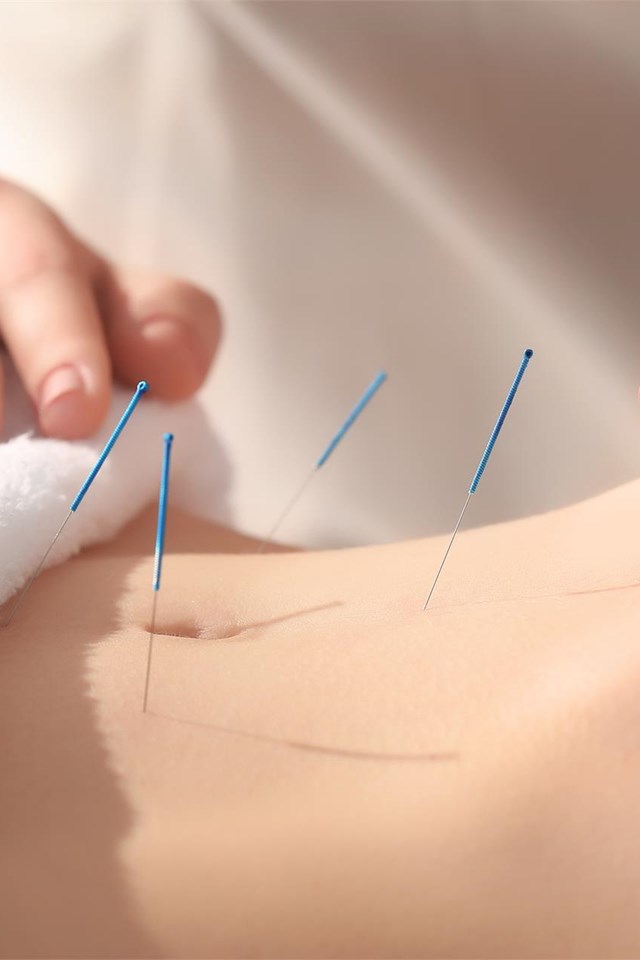  ¿Conoces todos los beneficios de la acupuntura?