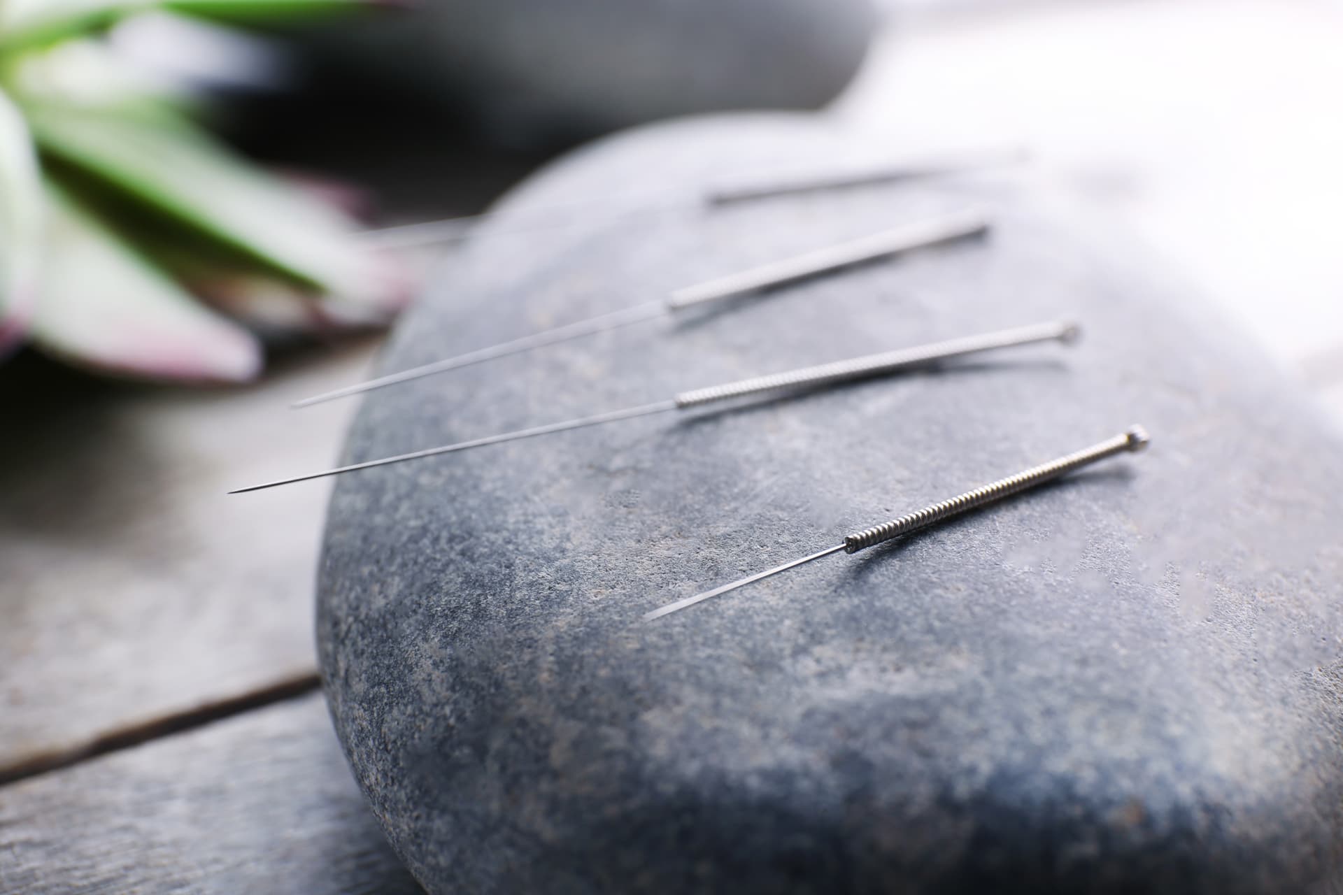 Beneficios de la acupuntura en Milladoiro
