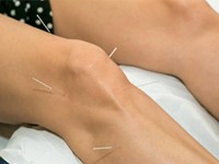¿Sabes cómo puede la acupuntura ayudarte?
